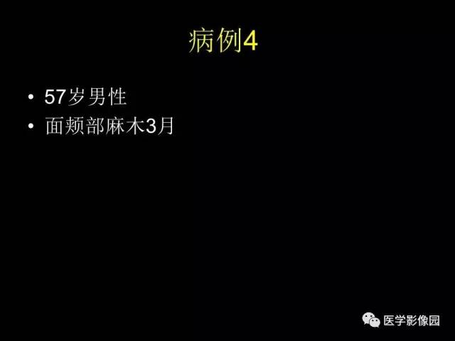 【PPT】头颈部恶性肿瘤影像诊断 重视颅底神经孔道改变