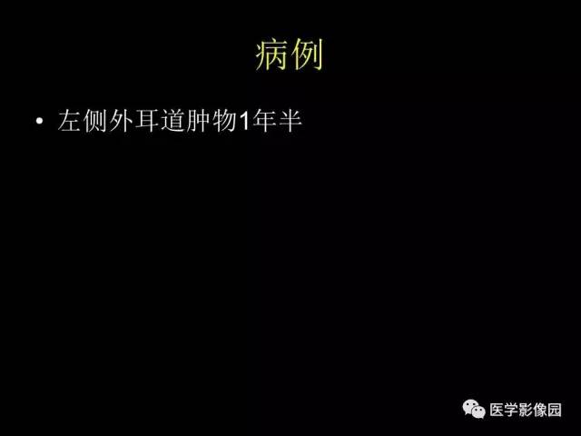 【PPT】头颈部恶性肿瘤影像诊断 重视颅底神经孔道改变