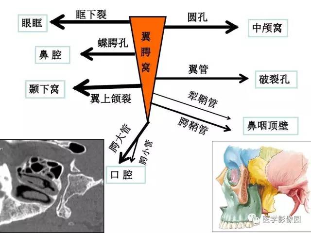 【PPT】头颈部恶性肿瘤影像诊断 重视颅底神经孔道改变