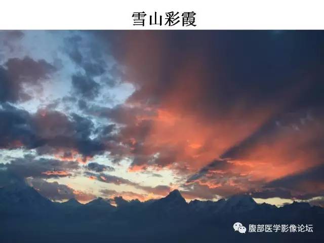 【PPT】磁共振成像小肠造影