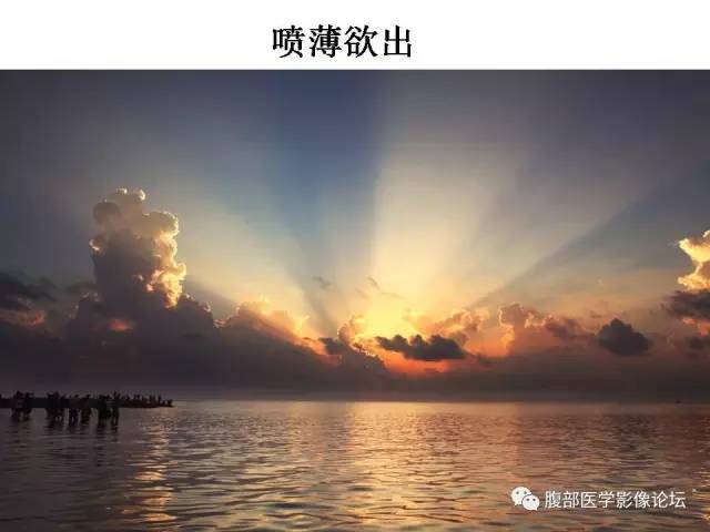 【PPT】磁共振成像小肠造影
