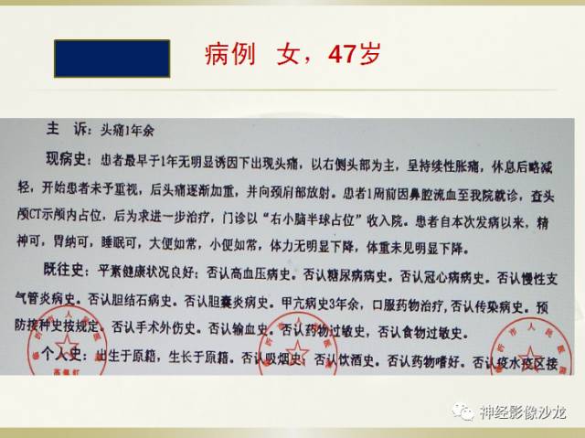 【病例】右枕部表皮样囊肿1例CT影像表现