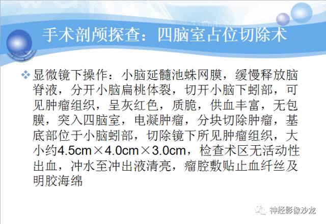 【病例】髓母细胞瘤一例MR影像表现