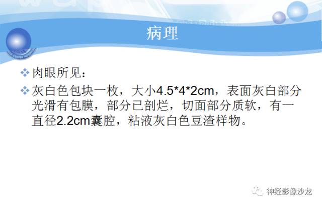 【病例】髓母细胞瘤一例MR影像表现