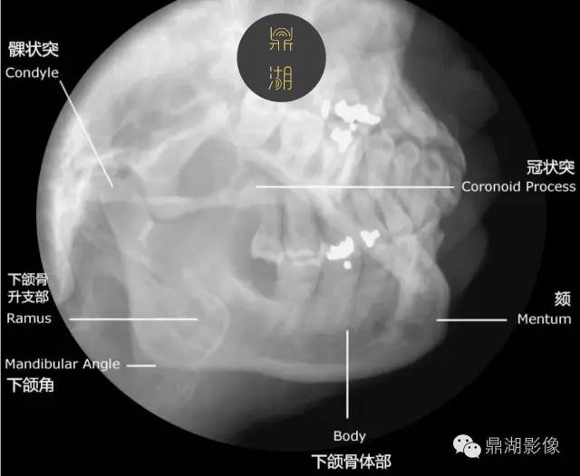 下颌骨解剖