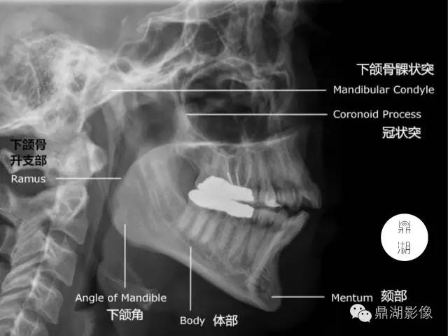 下颌骨解剖