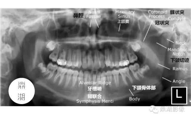 下颌骨解剖