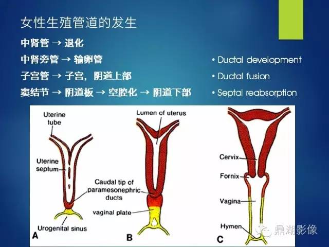 【PPT】苗勒氏管畸形的影像学诊断