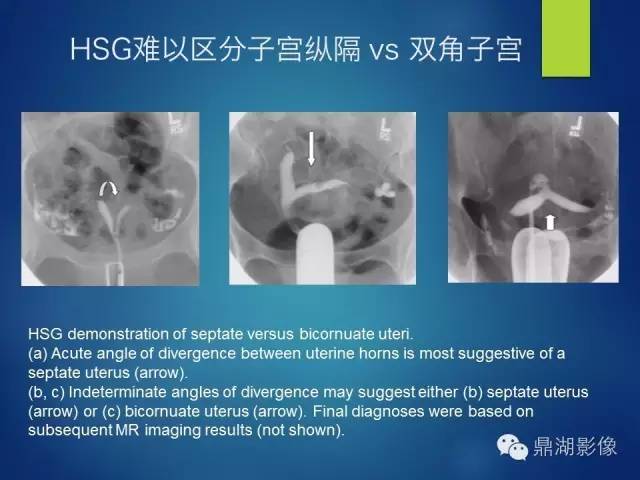 【PPT】苗勒氏管畸形的影像学诊断