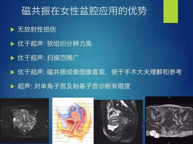 【PPT】苗勒氏管畸形的影像学诊断