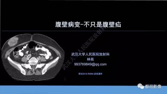 【PPT】腹壁病变-不只是腹壁疝