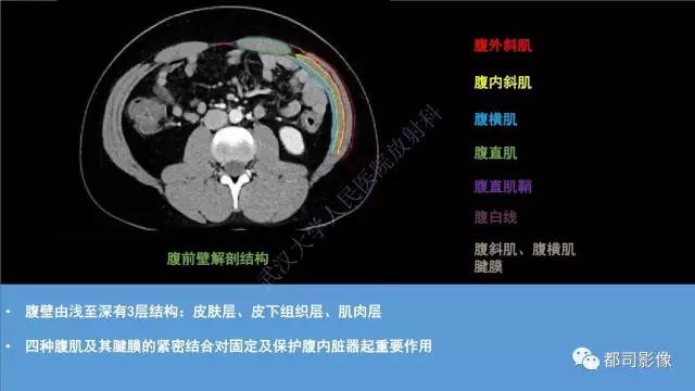 【PPT】腹壁病变-不只是腹壁疝