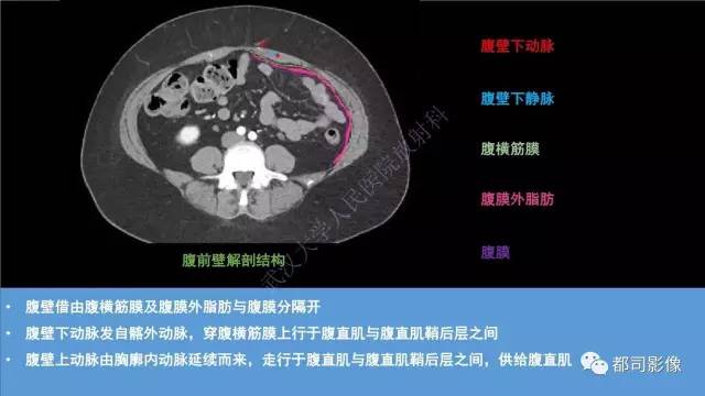 【PPT】腹壁病变-不只是腹壁疝