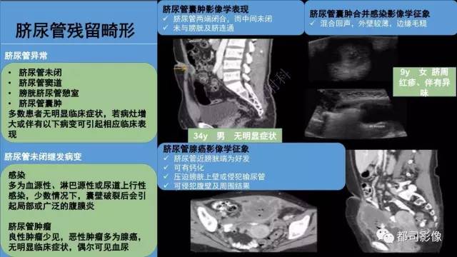 【PPT】腹壁病变-不只是腹壁疝