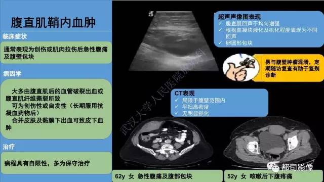 【PPT】腹壁病变-不只是腹壁疝