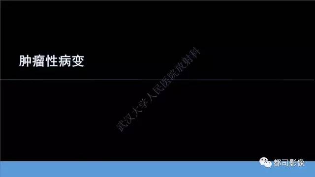 【PPT】腹壁病变-不只是腹壁疝