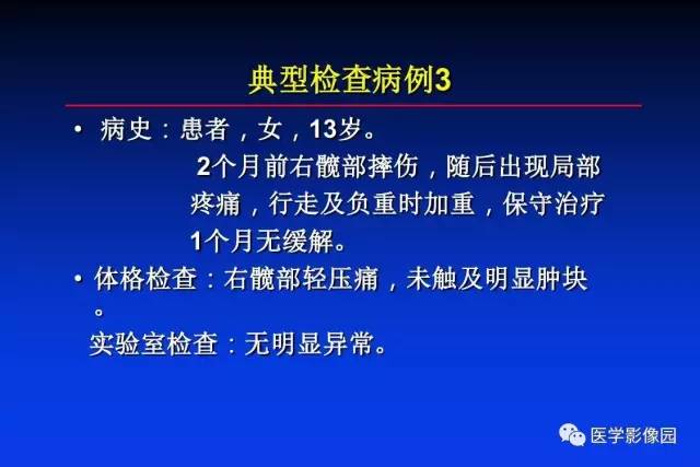 【PPT】骨肿瘤影像分析方法和诊断思路