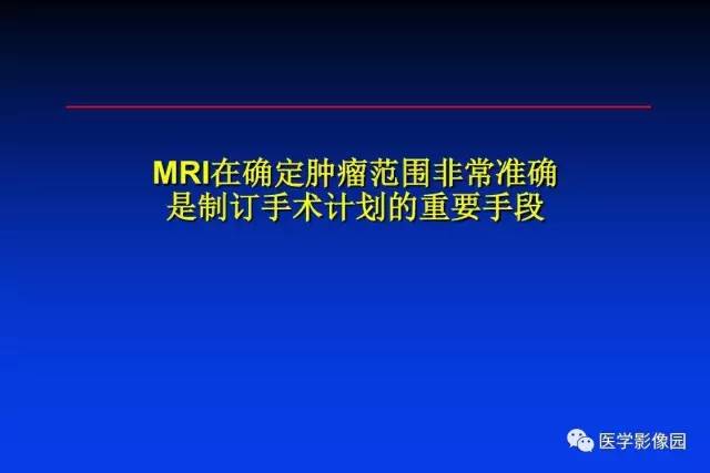 【PPT】骨肿瘤影像分析方法和诊断思路