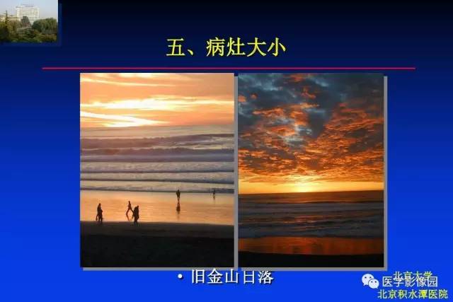 【PPT】骨肿瘤影像分析方法和诊断思路