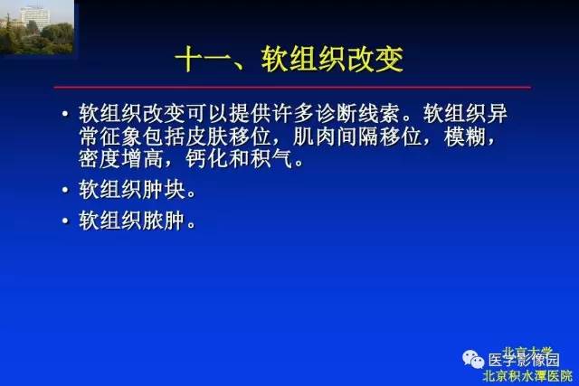 【PPT】骨肿瘤影像分析方法和诊断思路