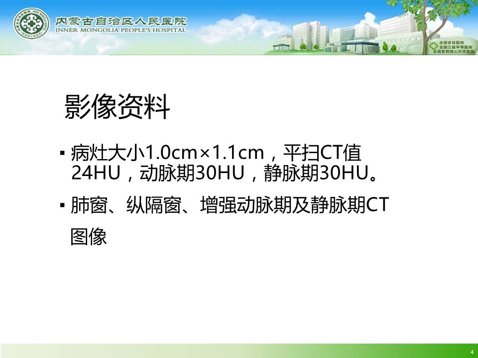 【病例】左肺上叶结核球1例CT