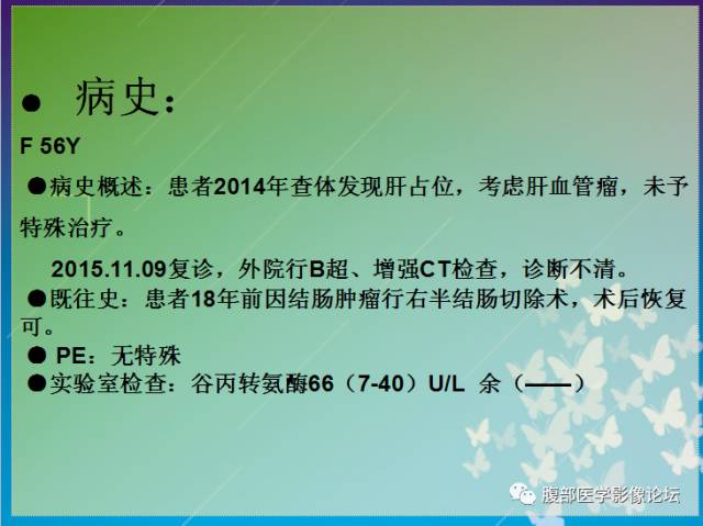 【病例】肝左叶胆管细胞癌1例CT及MR影像表现