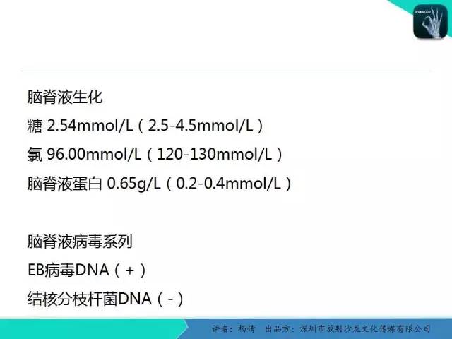【病例】病毒性脑炎1例MR影像表现