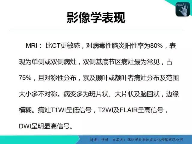 【病例】病毒性脑炎1例MR影像表现