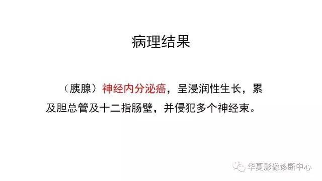【病例】胰腺神经内分泌肿瘤1例CT影像表现