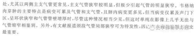 【病例】气管缩窄1例CT影像表现