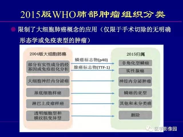 【PPT】肺癌影像诊断及进展