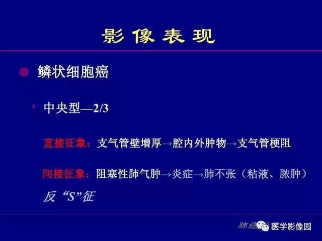 【PPT】肺癌影像诊断及进展