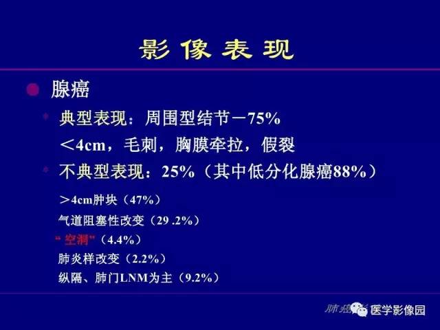 【PPT】肺癌影像诊断及进展