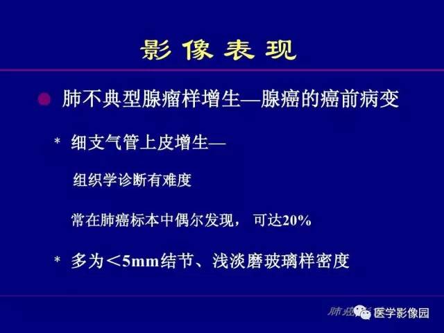 【PPT】肺癌影像诊断及进展