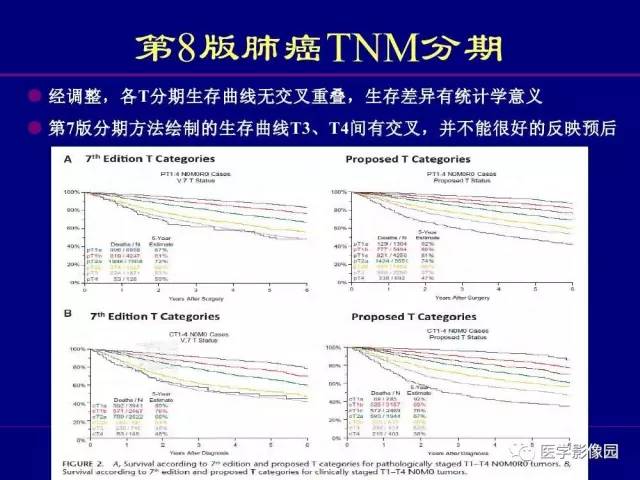 【PPT】肺癌影像诊断及进展