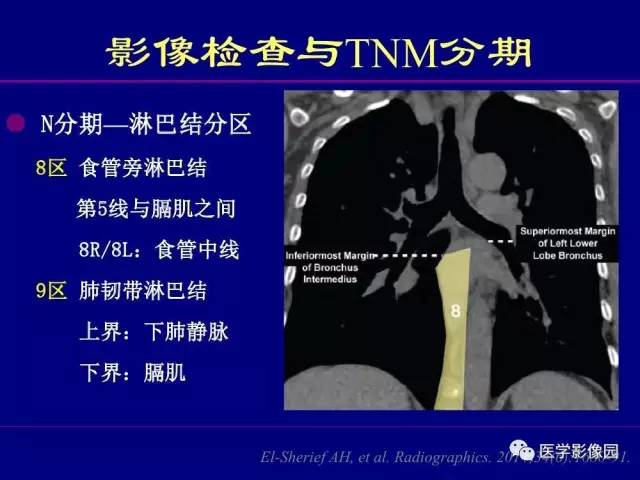 【PPT】肺癌影像诊断及进展