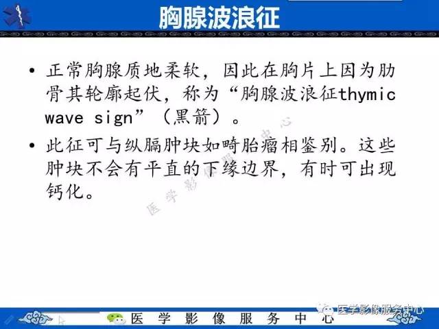 【影像征象】帆征和波浪征