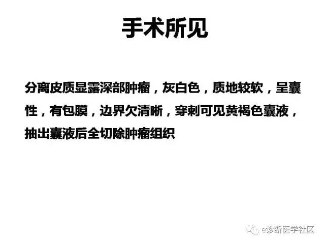 【病例】毛细胞型星形细胞瘤1例MR影像表现