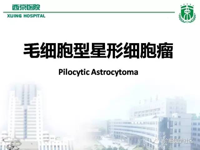 【病例】毛细胞型星形细胞瘤1例MR影像表现