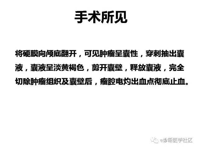 【病例】脑实质内室管膜瘤1例MR影像表现与鉴别