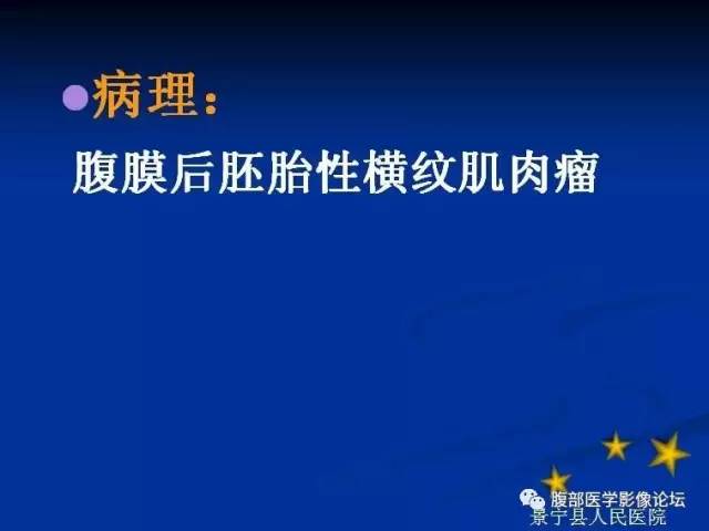 【病例】腹膜后胚胎性横纹肌肉瘤1例CT影像表现 【病例】腹膜后胚胎性横纹肌肉瘤1例CT影像表现