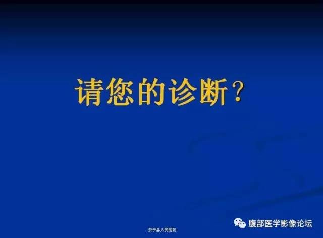 【病例】腹膜后胚胎性横纹肌肉瘤1例CT影像表现 【病例】腹膜后胚胎性横纹肌肉瘤1例CT影像表现
