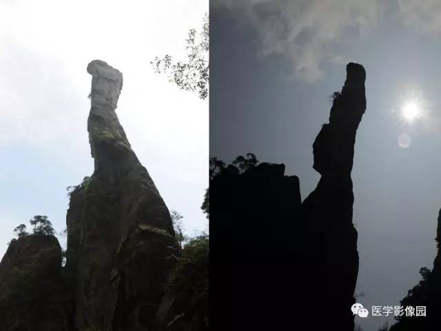 【PPT】鼻腔鼻窦肿瘤与肿瘤样病变的影像学诊断分析思路