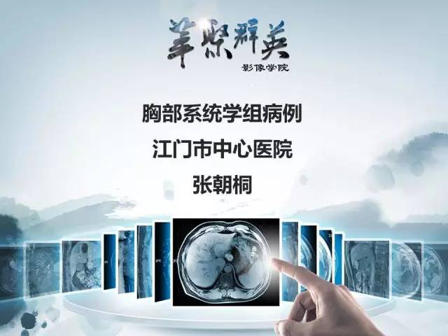 【病例】不典型肺癌1例CT影像表现