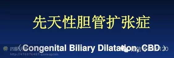 先天性胆管扩张症