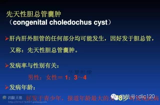 先天性胆管扩张症