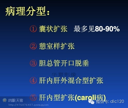 先天性胆管扩张症