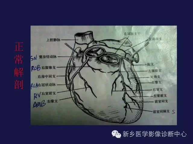 【PPT】64排后时代CT在心血管疾病的应用