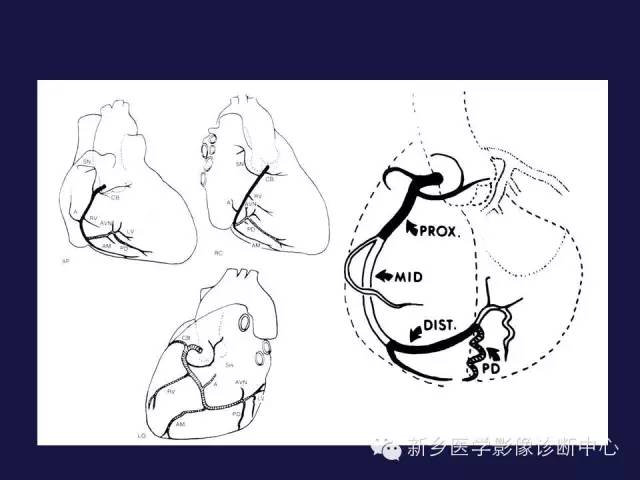 【PPT】64排后时代CT在心血管疾病的应用