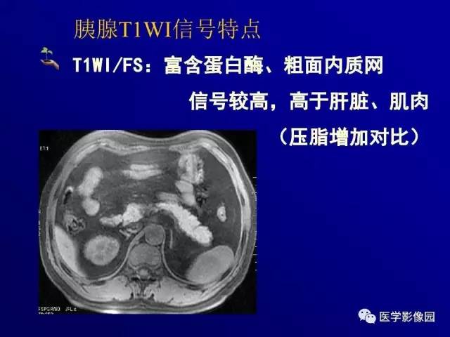 【PPT】胰腺及胆道肿瘤的CT、MRI诊断思路